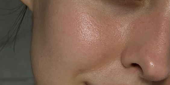 Kenapa Seri Wajah Anda Hilang: Punca Hormon Tersembunyi Yang Skincare Tak Dapat Atasi