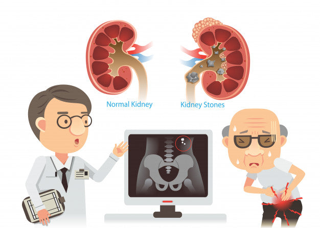 Tips To Treat Gallstones In The Bile By Dr. Hamid Arshat