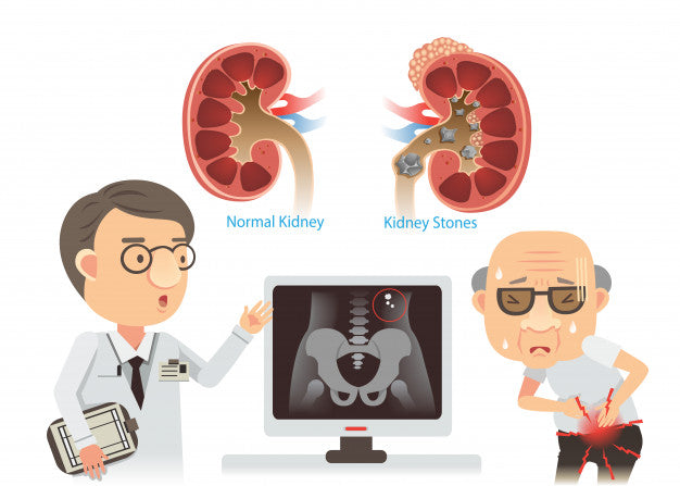 Tips To Treat Gallstones In The Bile By Dr. Hamid Arshat