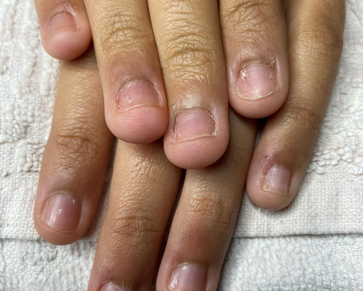 Stop Nail Biting: The Secret to Stronger, Healthier Nails Starts From Within - MyLustre.com