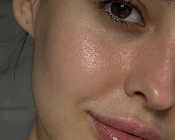 Why Your Glow Is Missing: The Hidden Hormonal Reason Your Skincare Can’t Fix - MyLustre.com