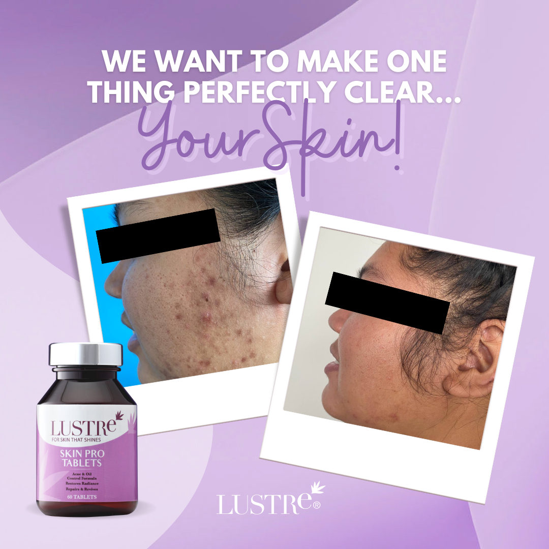 [Awarded Best Beauty Supplements] Lustre Skin Pro Tablet
